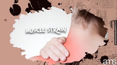 muscle strain